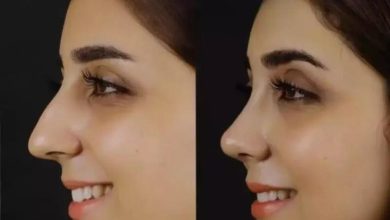 Discover the Beauty of Rhinoplasty in Dubai: Transform Your Look Today!