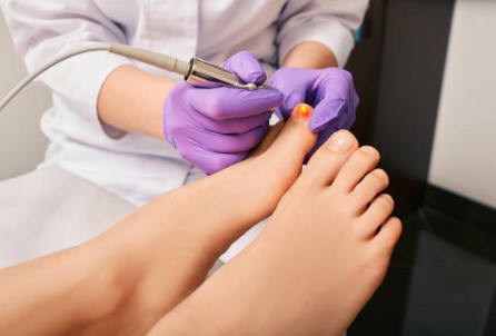 How Much Does Laser Nail Therapy Cost?