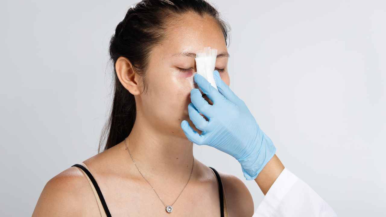 Top 5 Reasons to Choose Non-Surgical Rhinoplasty Fillers in Los Angeles