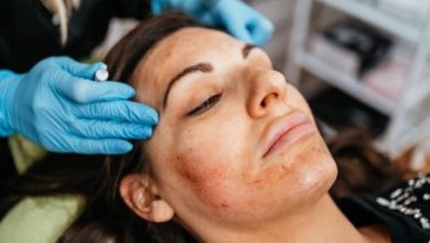 Who Can Benefit From PRP Facial Treatments In Tucson?