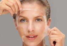 Chemical Peels & Vi Peel Towards Healthier Skin: Exposing the Benefits of Chemical Peels and Vi Peel Treatment NJ East Brunswick